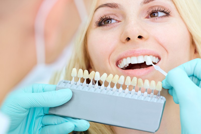 10 consejos para mantener tus dientes blancos y brillantes
