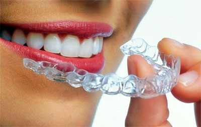 Tecnología Invisalign