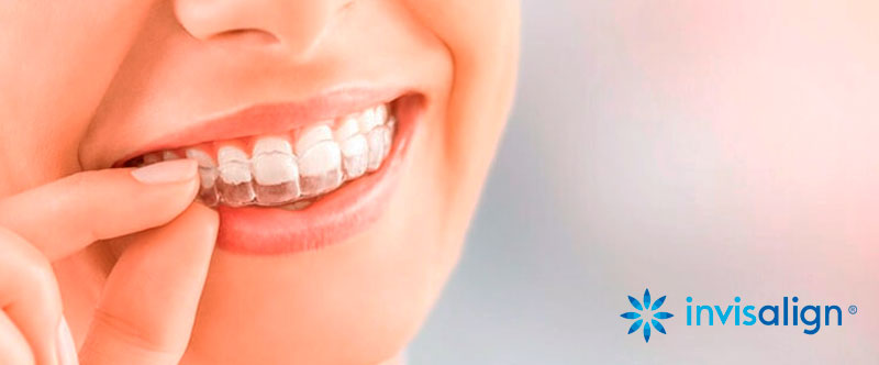 Face Orthodontics Specialist Group